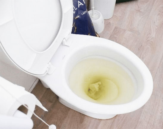 Địa chỉ hút hầm cầu phường Định Hòa Thành phố Thủ Dầu Một uy tín 2 giay-thai-ve-sinh-gay-tac-nghen